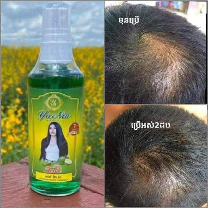 Hair Tonic