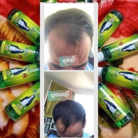 Hair Tonic