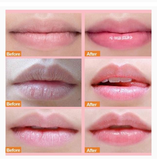 Collagen Crystal Lip Mask Set